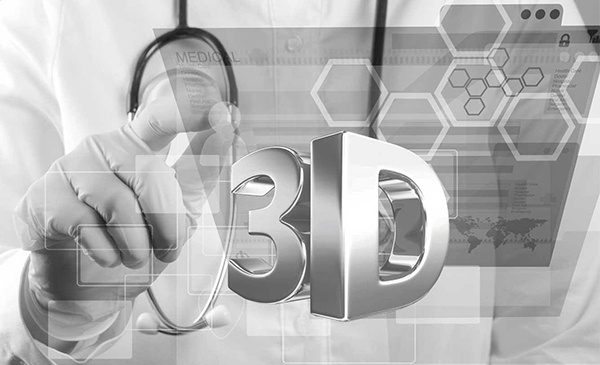 3D打印具有那些優(yōu)勢(shì)？