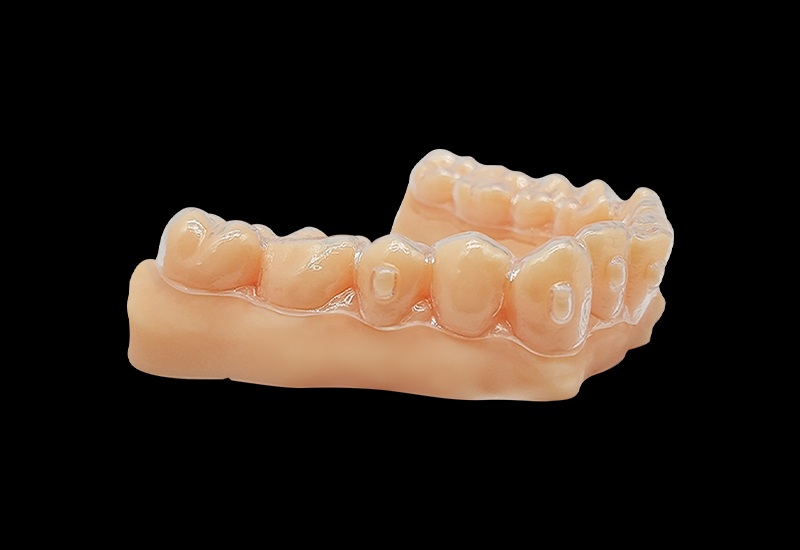 什么是3d打印正畸牙模？3d打印正畸牙模怎么做？